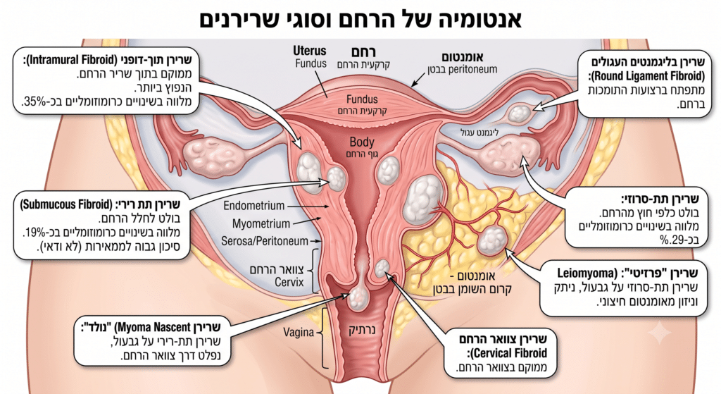 תרשים אנטומי של הרחם המציג את סוגי השרירנים השונים ומיקומם: שרירן תוך-דופני, תת-רירי ותת-סרוזי